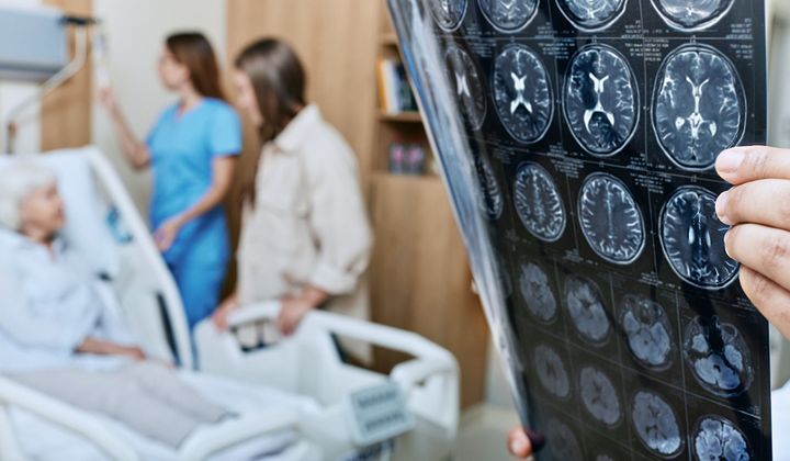 Maladie de Parkinson : un nouvel appareil à ultrasons permettrait d’en réduire les symptômes